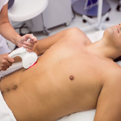 Quais vantagens a depilação masculina pode oferecer?